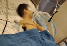 Denuncian posible mala praxis médica en el hospital del ISSSTE