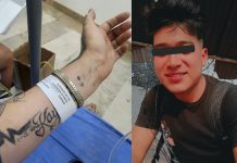 Joven pide apoyo a las autoridades tras sufrir agresión