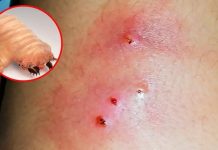 Brotes de miasis afectan a comunidades rurales de Chiapas